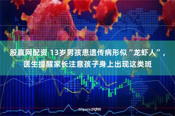 股赢网配资 13岁男孩患遗传病形似“龙虾人”，医生提醒家长注意孩子身上出现这类斑