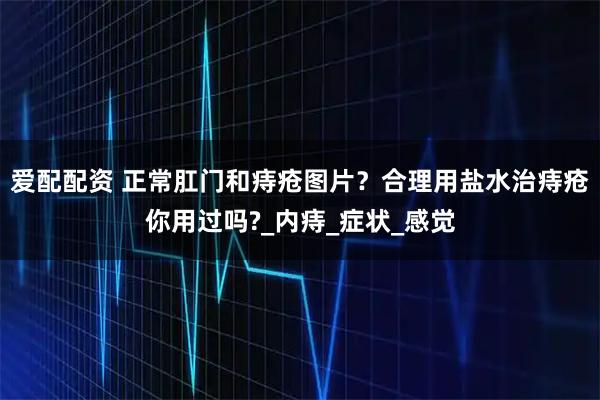 爱配配资 正常肛门和痔疮图片？合理用盐水治痔疮你用过吗?_内痔_症状_感觉